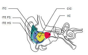 Audífonos Modelos Interior del Oído