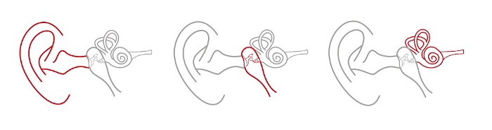 Partes del Oído, externo, medio e interno